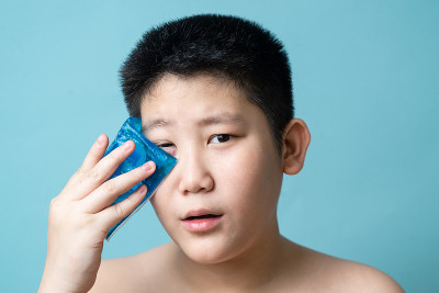 亚洲十多岁的男孩使用冷敷凝胶瘀伤脸上的蓝色背景。