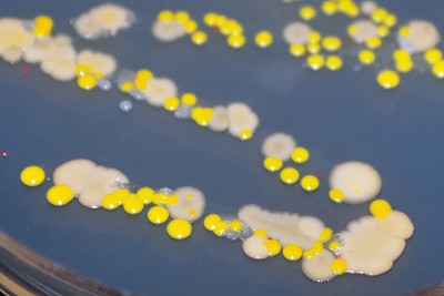 细菌和面包酵母菌落的宏观视图