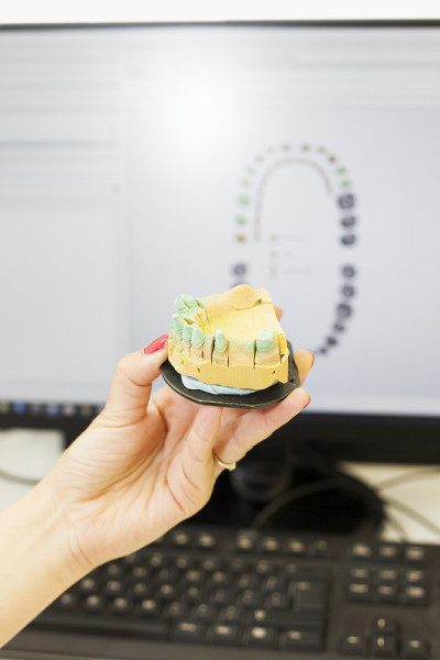 比较3d牙科扫描和牙科假体模具