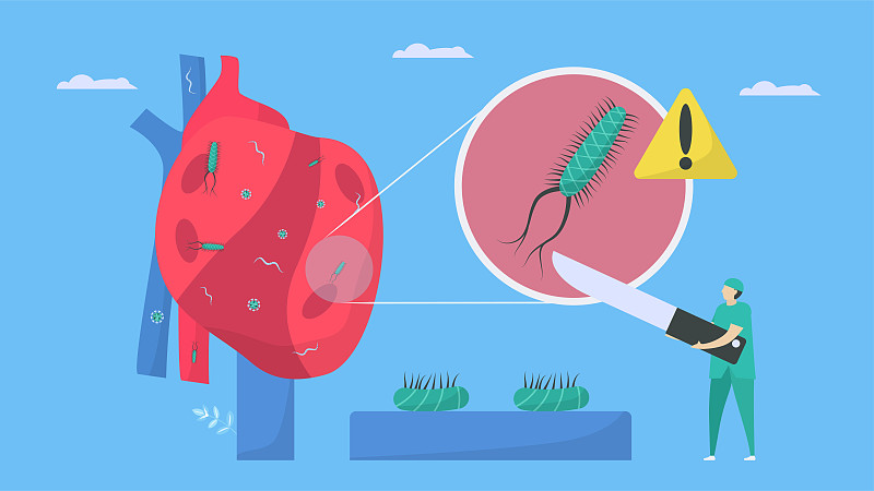 外科医生的心脏病治疗。这种疾病叫做心内膜炎。它是心内膜感染，即心腔和瓣膜。细菌、寄生虫和病毒正向血管