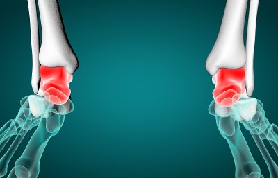 足踝或距骨的3D插图