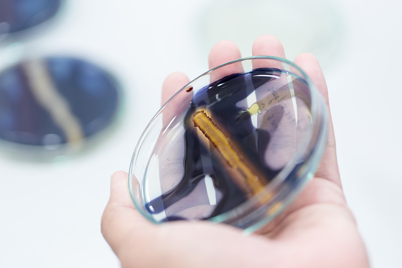 实验室用碘检测感染微生物。