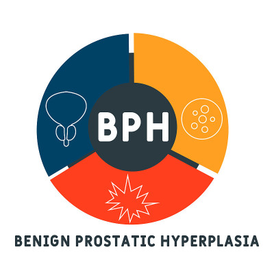 BPH:良性前列腺增生的缩写
