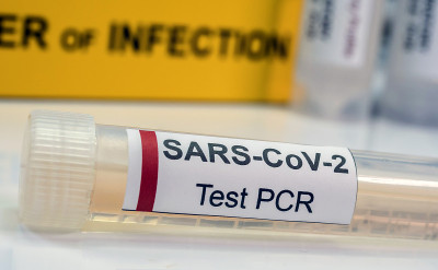 SarsCov2冠状病毒的小瓶pcr，概念图