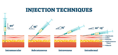 Injection techniques vector illustration. Medical 
