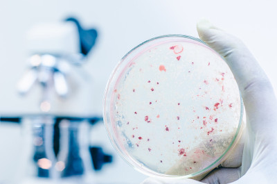 琼脂板上满是微生物和微生物
