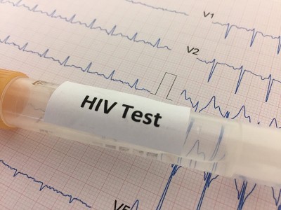 HIV实验室检测用试管