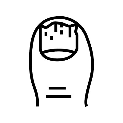 甲真菌病甲病线图标矢量插图