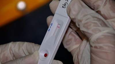 COVID-19病毒疾病检测、冠状病毒危机、全球大流行疫情、快速链球菌检测试剂盒、快速抗原检测(RA