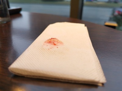 餐巾