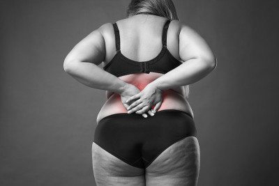 背部疼痛，肥胖女性背部疼痛，超重女性身体上的灰色背景