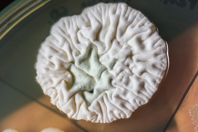 实验室培养皿中细菌和真菌的研究。