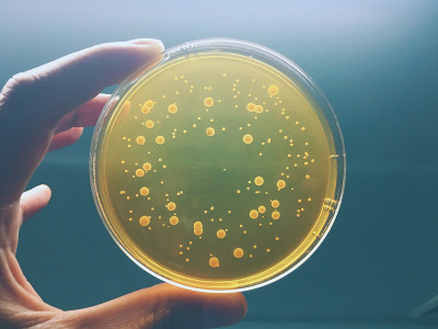 琼脂板上满是微生物和微生物