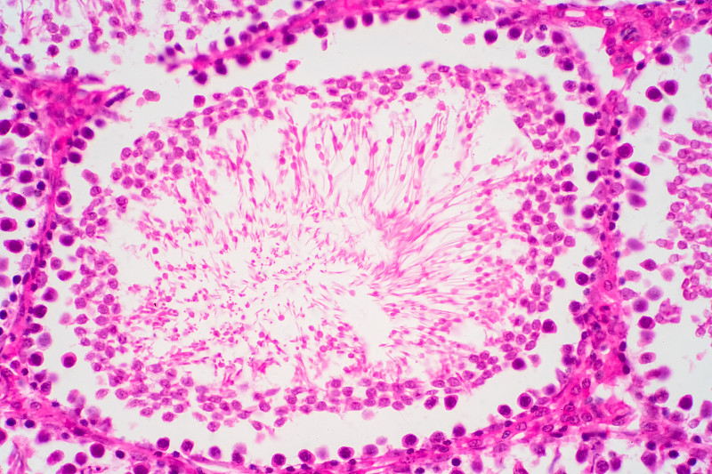 显微镜下人类精子的睾丸形态。病理教育用显微图显示精子。