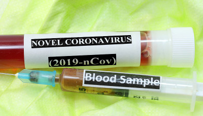 冠状病毒血液试管和注射器