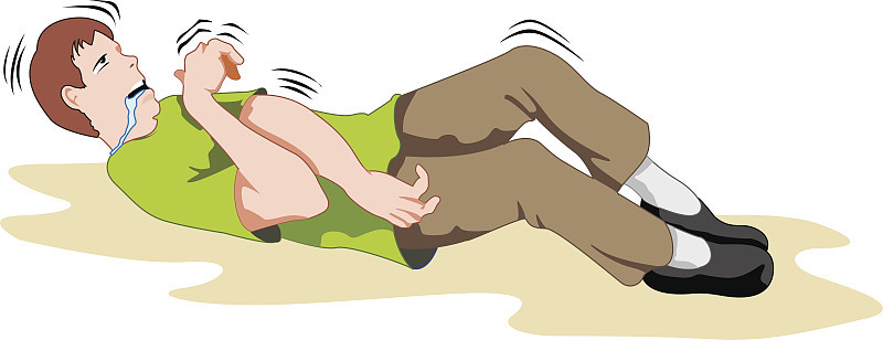 癫痫急救