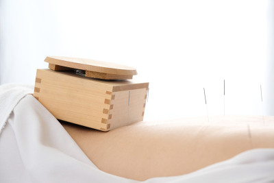 盒灸法放置在女性腰部的一个明亮的针灸中心