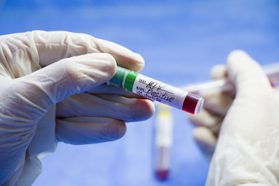Hiv and aids infection test, hand and tube with bl