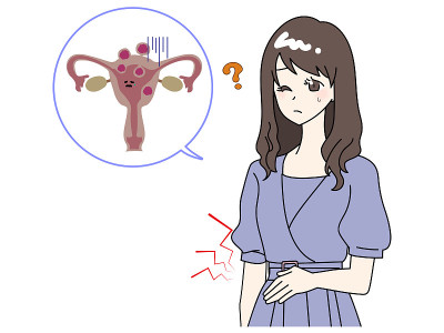 患有子宫肌瘤的妇女