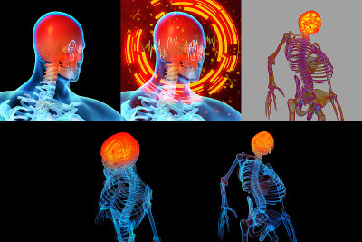 疼痛的脖子的3D渲染插图