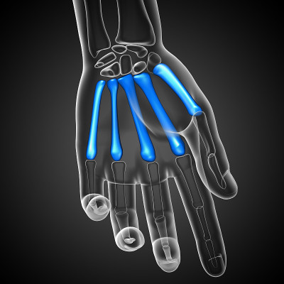 掌骨的3d渲染医学插图