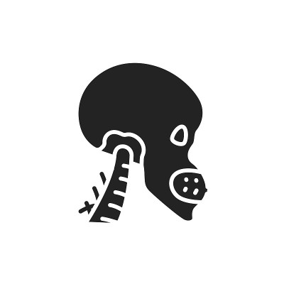 Acromegaly disease color line icon. Isolated vecto