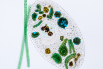 在显微镜下，Frontonia sp.是一种自由生活的单细胞纤毛虫原生生物。