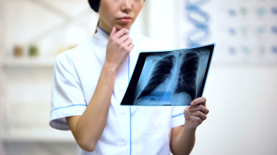 专业女性治疗师看着肺部x光片，思考诊断
