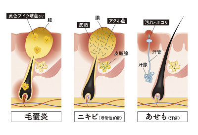 皮肤的横截面在前面30处