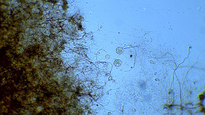 纤毛虫微观生物