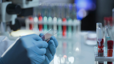 实验室科学家准备用血液样本做显微镜载玻片
