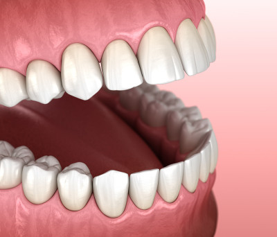 正常咬合的健康人类牙齿，宏观视图。医学上准确的牙齿3D插图