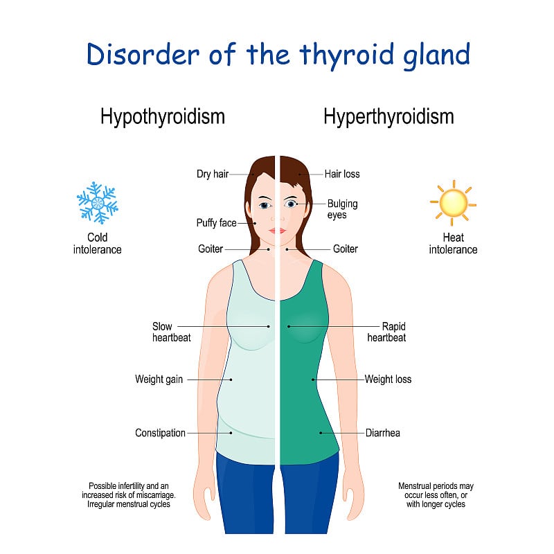 Female with Signs and symptoms of different thyroi