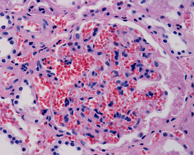 肾glomerulus