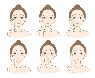 皮肤问题变异(女性)