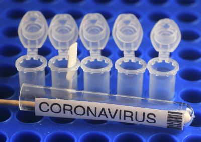 利用CRISPR诊断技术检测Covid-19的生物技术