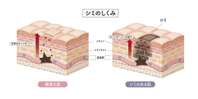 Cross section of the skin 2