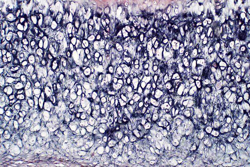 人体软骨骨光镜下切片组织学教育。苏木精和伊红染色技术的组织学。