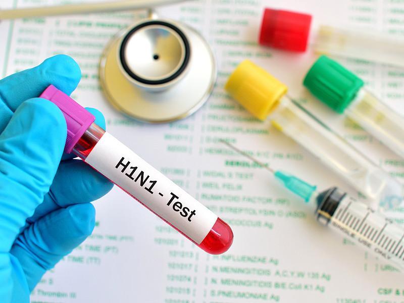 甲型H1N1流感的测试