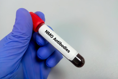血液标本进行视神经脊髓炎(NMO)抗体检测，诊断中枢神经系统。德维克的疾病。水通道蛋白4
