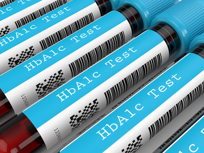 HbA1c成排血管的3d渲染