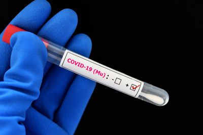 Mu变异COVID-19阳性