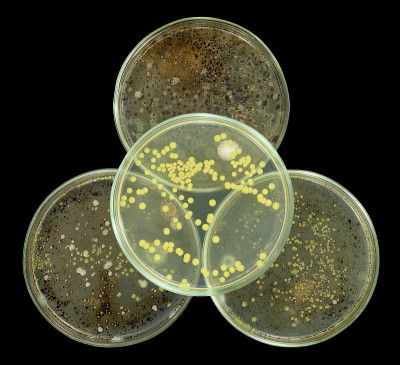 生物危害符号的解释由培养皿组成分离