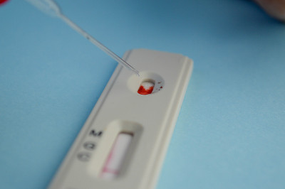 在蓝色背景下进行冠状病毒检测。一个修了红色指甲的女孩做了血液测试。为了得到正确的结果，她在一滴血中加