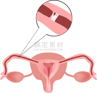 输卵管,白色,分离着色,健康保健,脚踏车,挫败,重复