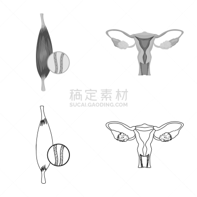 人,品牌名称,人类的生殖器官,卵巢,人类骨架,收集,设计,生病