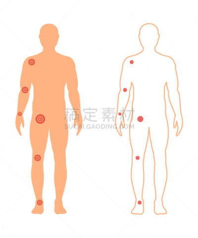 男性,关节,痛苦,白色,健康保健,人,身体受伤,男人,剪影,生病