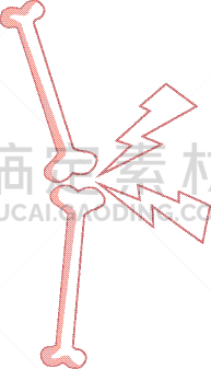 内侧的,问题,关节,骨骼,痛苦,鼓起肌肉,矢量,健康保健,身体受伤,生病