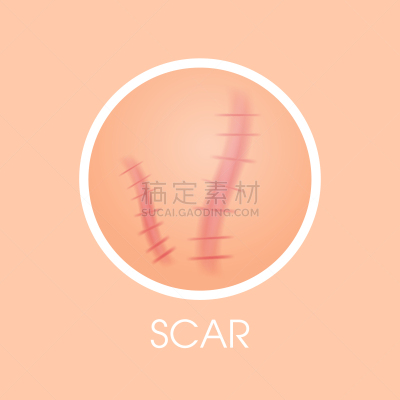 疤,问题,概念,美容院,皮肤,毛孔,字体,粉刺,平坦的,美容