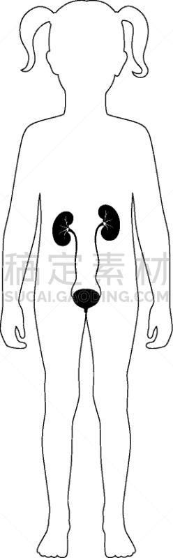 分离着色,肾脏,健康保健,门诊部,女人,品牌名称,儿童,透析过滤器,剪影